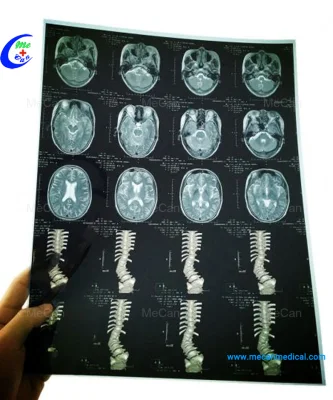 Película médica de rayos X de inyección de tinta seca para radiología, impresora de película hospitalaria